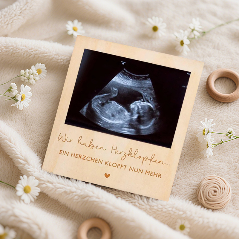 Echografie Zwangerschap Aankon - Photo Booth Frame recensie en prijs