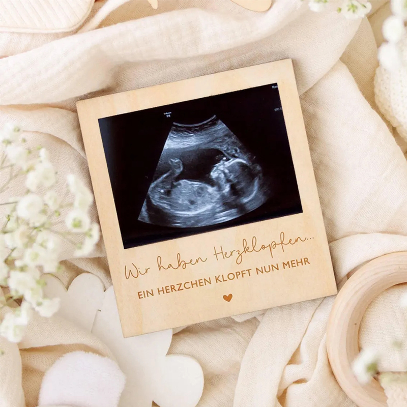 Echografie Zwangerschap Aankon - Photo Booth Frame recensie en prijs